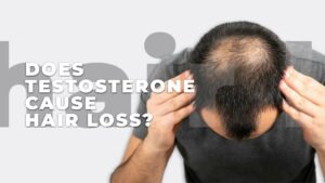 Does Testosterone Cause Hair Loss