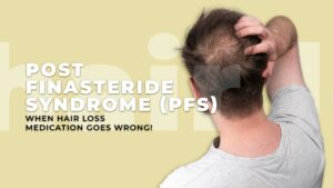 PFS- When Hair Loss Medication Goes Wrong