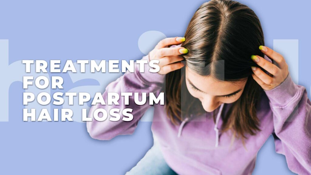 Treatments for Postpartum Hair Loss